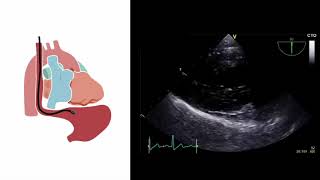 What is an Echocardiogram [upl. by Kopp]