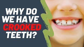 Why do we have crooked teeth  Dentist Explained 2021 [upl. by Reldnahc]