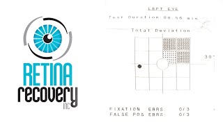 FAQ  Post Vitrectomy  How Much Sight Did I Get Back [upl. by Bjorn183]