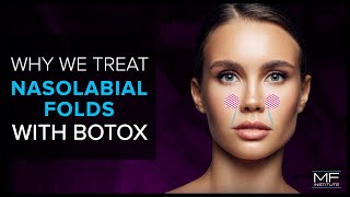 Botox Injections  Anatomy and Technique [upl. by Ahsito902]