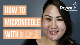 How to microneedle at home with Dr Pen  Dr Pen Australia  Microneedling  Skin Needling  CIT [upl. by Ahsiuqat422]