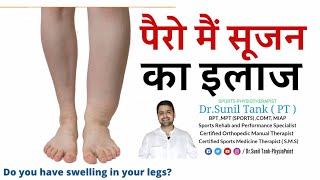 leg swelling treatment at home  Best 6 exercise for reduce leg swelling  pero ki sujan ka ilaj [upl. by Seabury]