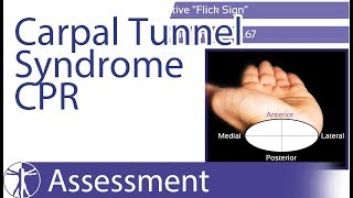 Wainner Clinical Prediction Rule CPR  Carpal Tunnel Syndrome CTS [upl. by Redep]