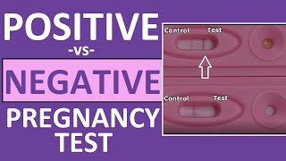 Pregnancy Test Positive vs Negative Results Time Lapse [upl. by Nnaylime47]