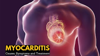 ECG Interpretation Practice  Pericarditis on EKG Explained [upl. by Alegnatal]