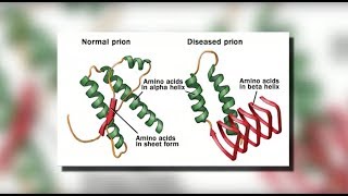 What Is Chronic Granulomatous Disease [upl. by Eimak]