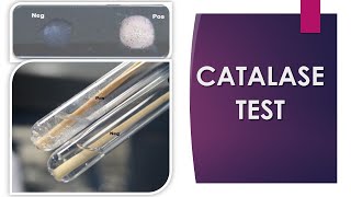 Catalase Test [upl. by Baldridge]