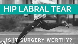 How to treat hip labral tears [upl. by Friday]