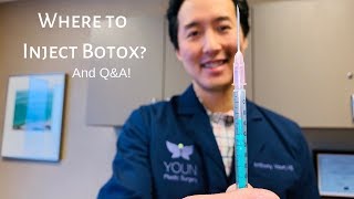 UNDER EYE BOTOX Experience amp Footage  BeforeAfter Cost Pain Bruising [upl. by Trometer]