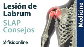 Consejos para solucionar la lesión labrum de hombro SLAP [upl. by Atiuqcir146]