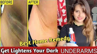 Home Remedy Tips UnderArms WhiteningRid Dark Spotsamp Patches Skincare tipFalak Naaz FalakNaaz [upl. by Esinek710]