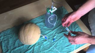 Paracentesis using Turkel Safety Fluid Drainage System [upl. by Alica]