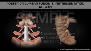 Spinal cord Segmentation [upl. by Nylasej952]