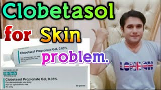 CLOBETASOL Propionate Cream Dermovate uses side effects [upl. by Ecirtnahs]