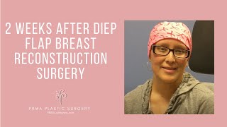 Breast reconstruction after breast cancer  Plastic Surgery [upl. by Nosde41]