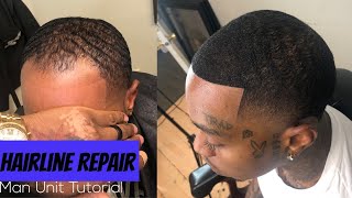 SHOCKING TRANSFORMATION Must see Hairline Repair Service  Best Man Unit Tutorial [upl. by Towny]