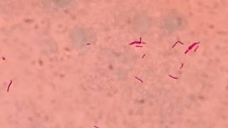 AFB stained slide of Mycobacterium tuberculosis like bacteria on counter stain Malachite green [upl. by Paxton225]