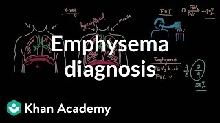 Emphysema diagnosis  Respiratory system diseases  NCLEXRN  Khan Academy [upl. by Adnic77]