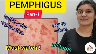 SKIN LESIONS PEMPHIGUS PART1 [upl. by Reggie]