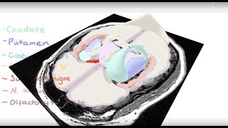 Basal Ganglia 3D Tour [upl. by Asamot930]