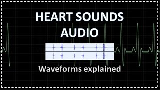 Normal Heart Sounds  Auscultation  Audio [upl. by Howund]