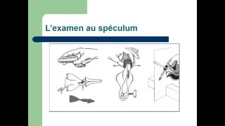 GYNECOLOGIE L’examen en gynécologie [upl. by Niwhsa48]