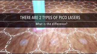 Laser Hair Removal  How does it work [upl. by Tnemelc115]