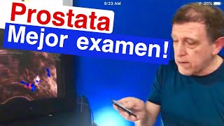 El mejor examen para próstata [upl. by Ecinaj113]