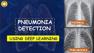 PNEUMONIA Detection Using Deep Learning in Tensorflow Keras amp Python  KNOWLEDGE DOCTOR [upl. by Ecidnacal]