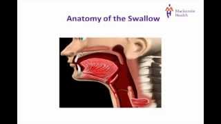 Brainstem Stroke Syndromes [upl. by Kecaj]