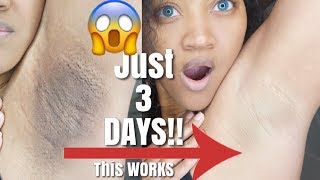 Watch How I Lighten and Get Rid Of My Dark Armpits FAST Before and After Results [upl. by Tommy524]