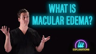 What Is Macular Edema [upl. by Mojgan]