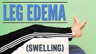 Top 7 Exercises for Leg Edema or Swelling Program or Protocol for Edema [upl. by Holton]