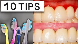 10 Tips To Reduce Swollen Gums At Home [upl. by Bruce]