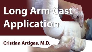 Long Arm Cast Application [upl. by Phila]