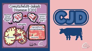 Creutzfeldt Jakob Disease CJD [upl. by Malha430]