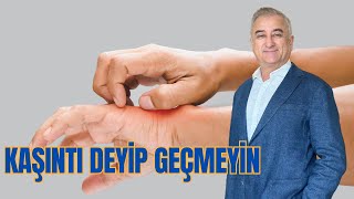 KAŞINTI DEYİP GEÇMEYİN [upl. by Asel952]