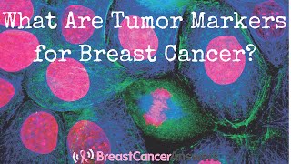 What Are Tumor Markers for Breast Cancer [upl. by Redep372]