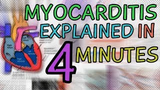 WHAT IS MYOCARDITIS MYOCARDITIS EXPLAINED IN 4 MINUTES  CAUSES SYMPTOMS DIAGNOSIS TREATMENT [upl. by Novaat470]