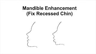 Mandible Enhancement  Fix Recessed Chin  V Shaped Face Subliminal [upl. by Llirpa967]