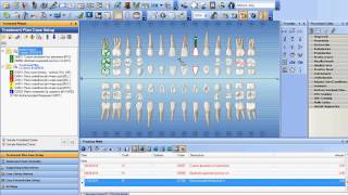 Charting a Supernumerary Tooth in Dentrix [upl. by Esila917]