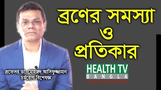 মুখের ব্রণ দূর করার উপায়  Mukher Bron Dur Korar Upay [upl. by Elrebma]