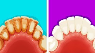 Tooth Scaler Help Remove Plaque Clean Teeth Like A Real Dentist Today [upl. by Gerick13]