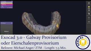 2021 Exocad 30  Tutorial Preview  Galway Provisorium oder Eierschalenprovisorium [upl. by Nair978]